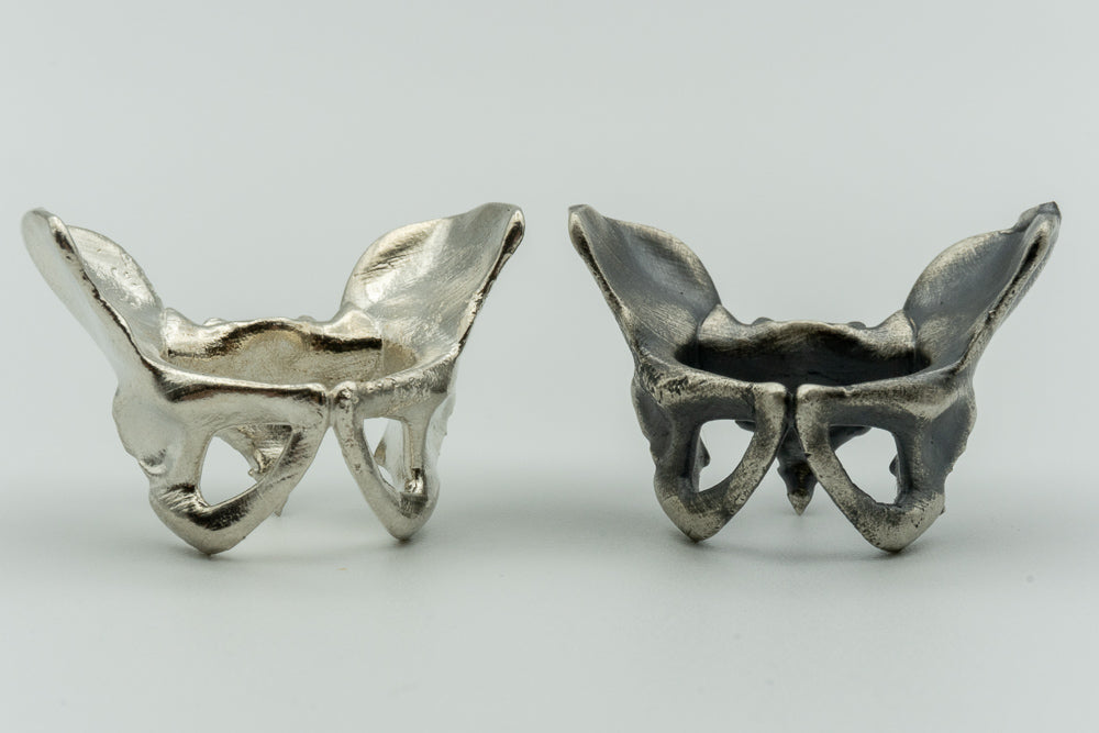 Pelvis
