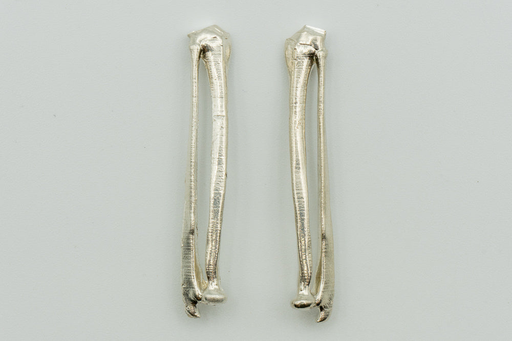 Radius Ulna Pair